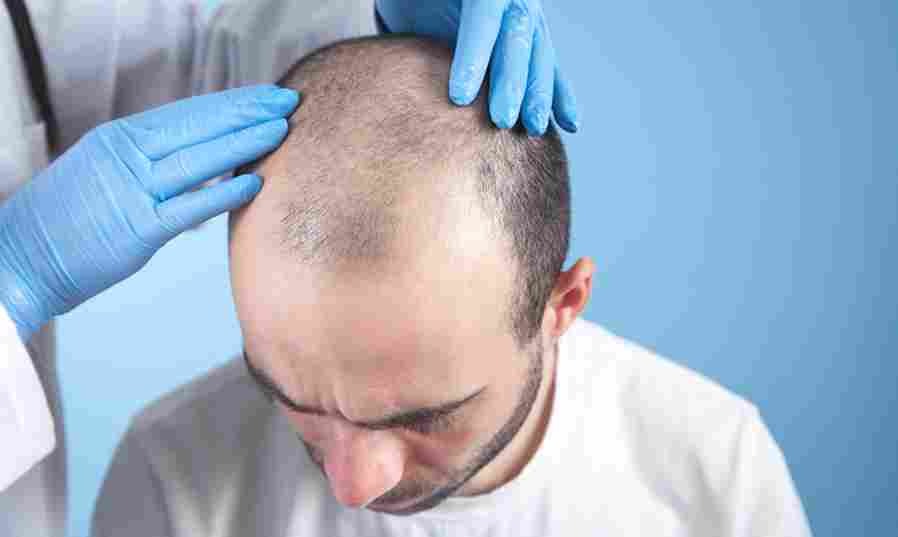 Premium Hair Transplant Turkey with Sapphire Hair Clinic