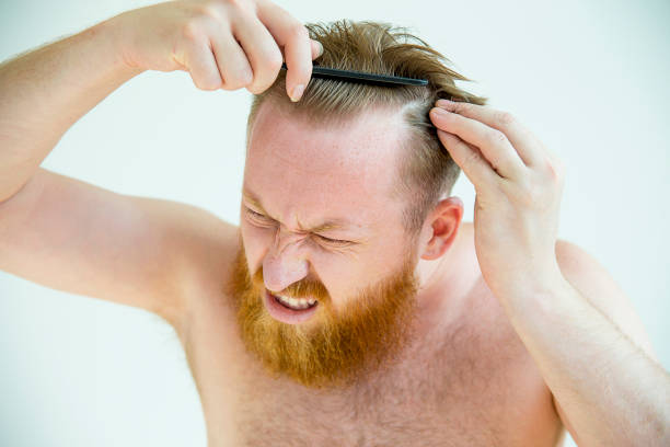 Hair Transplant Turkey Cost: Why Istanbul Clinics Lead the Industry